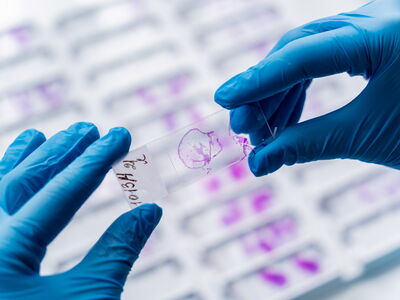 © romaset - stock.adobe.com